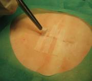 Curso de suturas